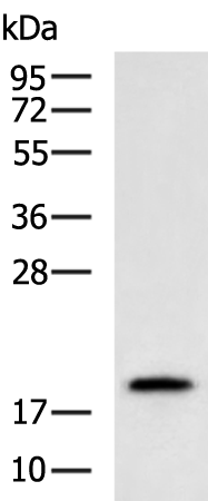 Rabbit Polyclonal Antibody to RPL35