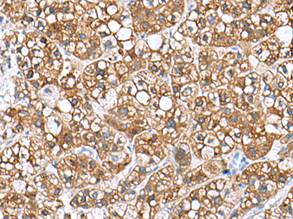 Rabbit Polyclonal Antibody to PHLDA3