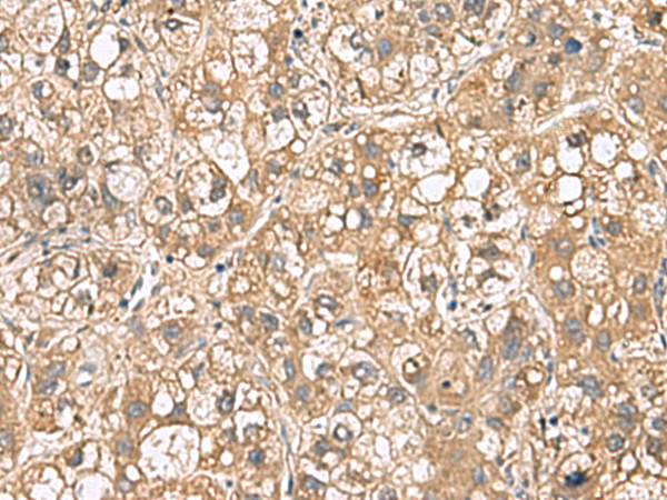 Rabbit Polyclonal Antibody to PTPRS