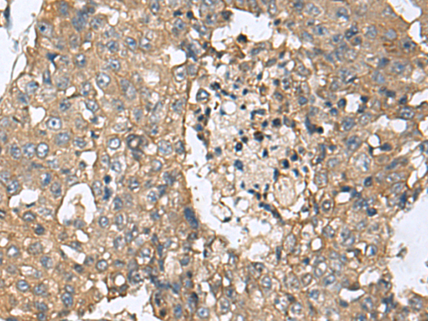 Rabbit Polyclonal Antibody to CD59