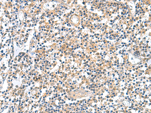 Rabbit Polyclonal Antibody to GEMIN7