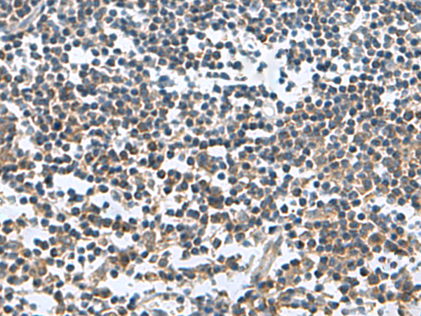 Rabbit Polyclonal Antibody to FAM107B