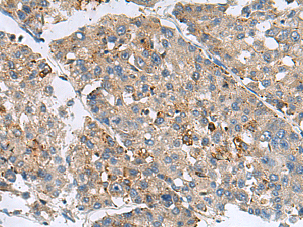 Rabbit Polyclonal Antibody to MED31