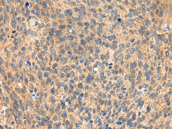 Rabbit Polyclonal Antibody to MIA