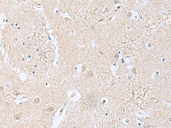 Rabbit Polyclonal Antibody to TPD52L3