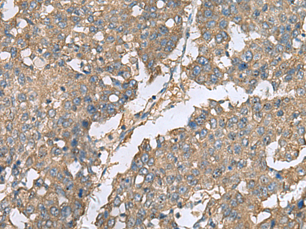 Rabbit Polyclonal Antibody to EIF1AX