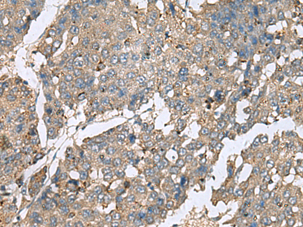 Rabbit Polyclonal Antibody to PLA2G2A