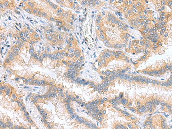 Rabbit Polyclonal Antibody to RPS16