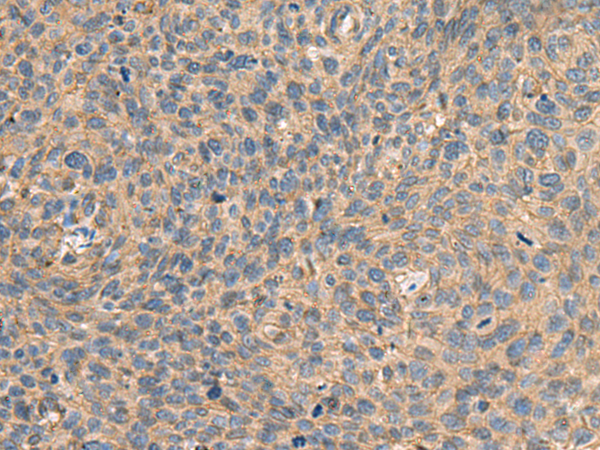 Rabbit Polyclonal Antibody to AHNAK