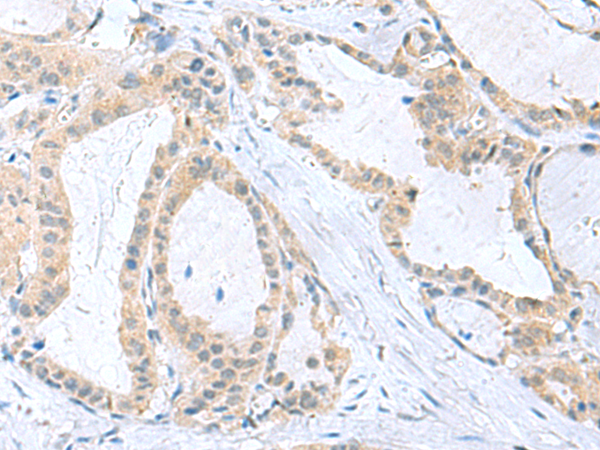 Rabbit Polyclonal Antibody to PDE6D