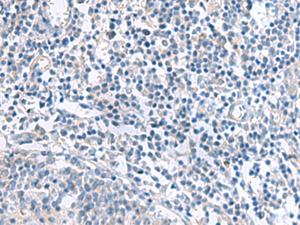 Rabbit Polyclonal Antibody to MYL1