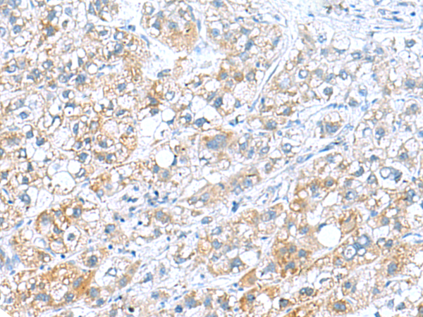 Rabbit Polyclonal Antibody to DNAL1