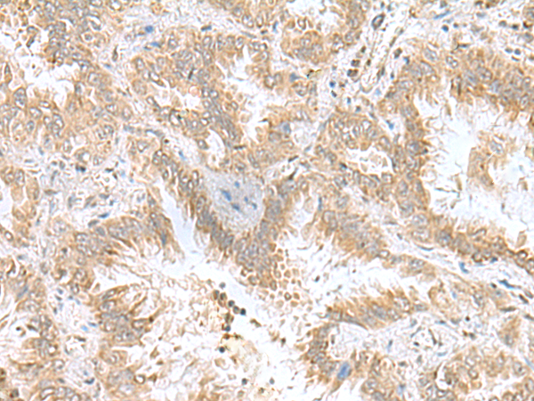 Rabbit Polyclonal Antibody to CPLX3