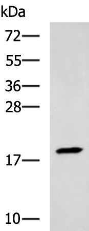 Rabbit Polyclonal Antibody to TNNC2