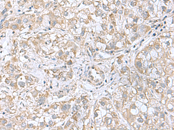 Rabbit Polyclonal Antibody to CGB5