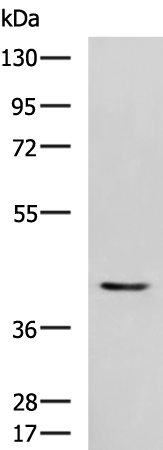 Rabbit Polyclonal Antibody to STK32A