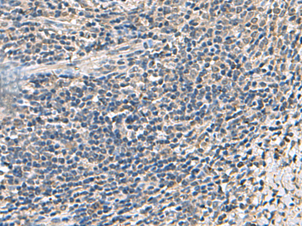 Rabbit Polyclonal Antibody to ATP5F1D