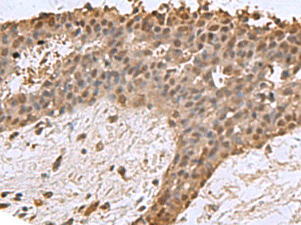 Rabbit Polyclonal Antibody to DCTPP1