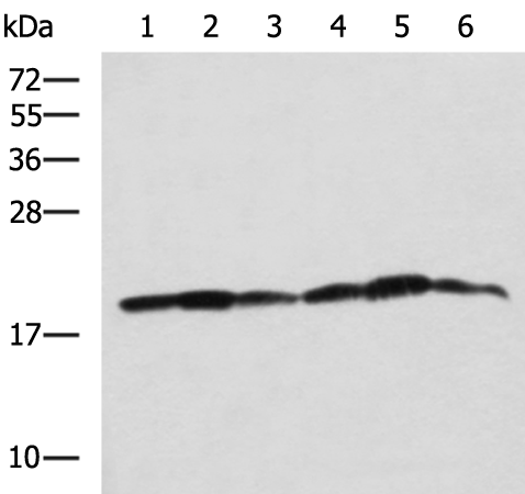 Rabbit Polyclonal Antibody to BLOC1S6