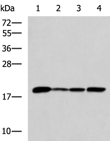 Rabbit Polyclonal Antibody to AK6