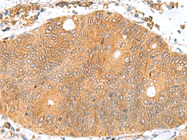 Rabbit Polyclonal Antibody to TXNDC12