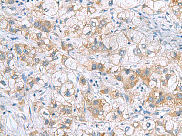Rabbit Polyclonal Antibody to GCSH