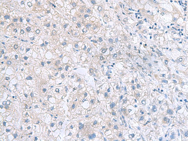 Rabbit Polyclonal Antibody to MYDGF