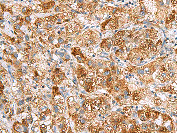 Rabbit Polyclonal Antibody to NMU