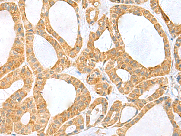 Rabbit Polyclonal Antibody to PPIH