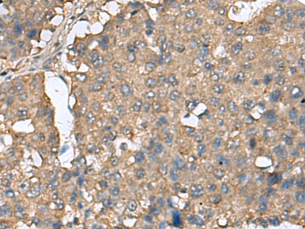 Rabbit Polyclonal Antibody to EIF4A2