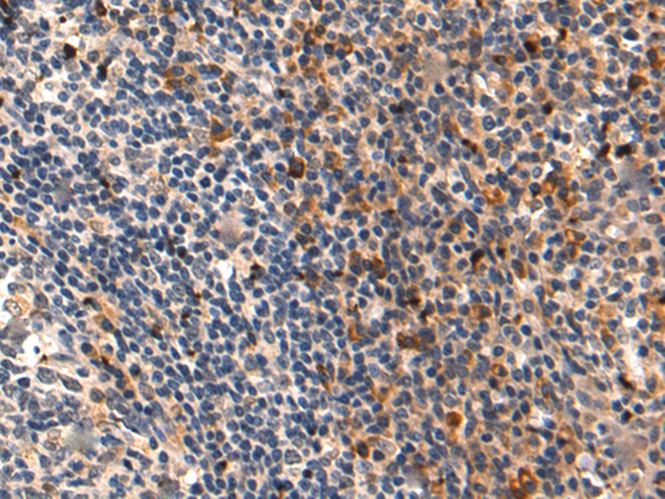 Rabbit Polyclonal Antibody to MFAP2