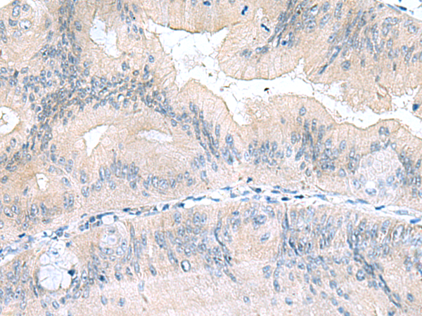 Rabbit Polyclonal Antibody to UBE2F
