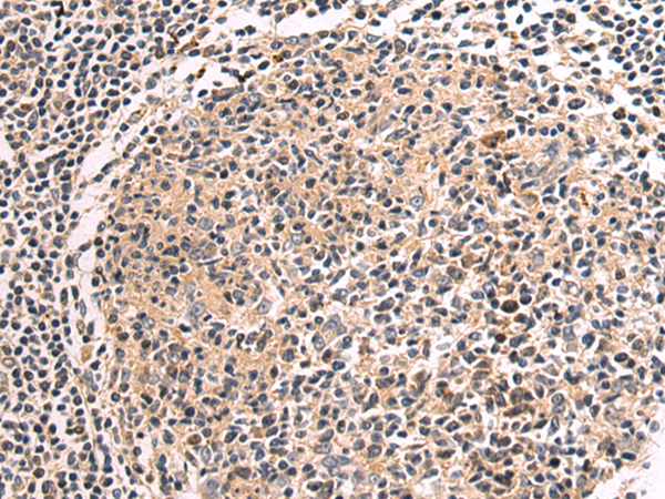 Rabbit Polyclonal Antibody to TNNI1