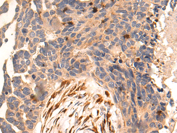 Rabbit Polyclonal Antibody to CENPBD1
