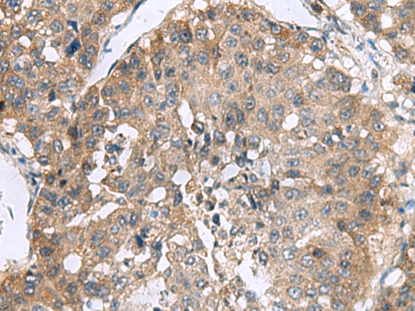 Rabbit Polyclonal Antibody to RPL18