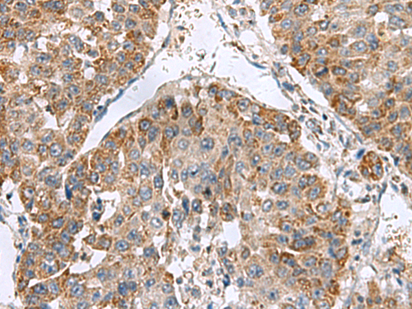 Rabbit Polyclonal Antibody to NFS1