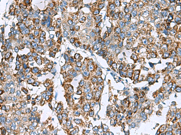 Rabbit Polyclonal Antibody to PRELID3B