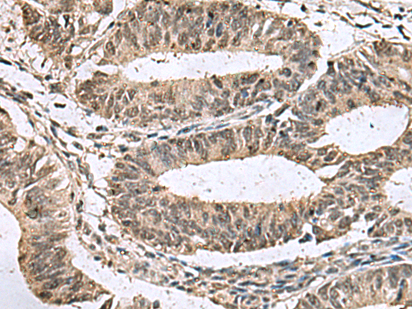 Rabbit Polyclonal Antibody to TMX3