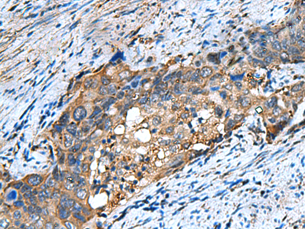 Rabbit Polyclonal Antibody to COMMD9