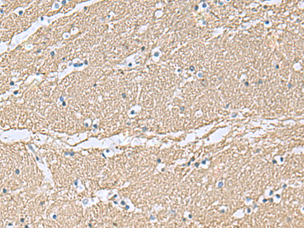 Rabbit Polyclonal Antibody to TAGLN3
