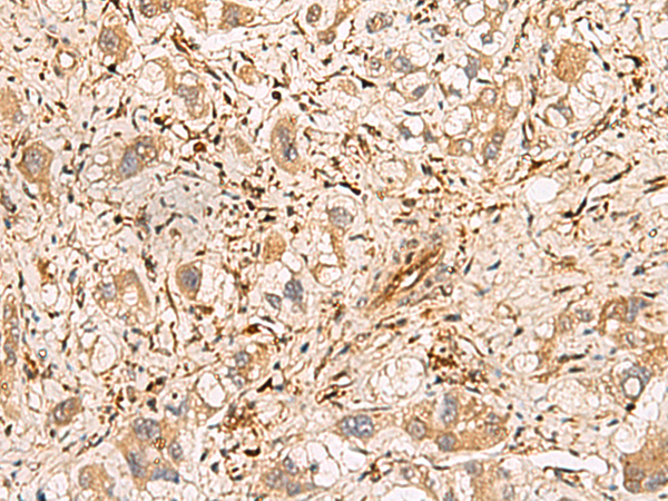 Rabbit Polyclonal Antibody to PLCB2