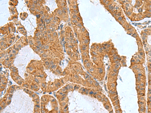 Rabbit Polyclonal Antibody to ITGB1BP1