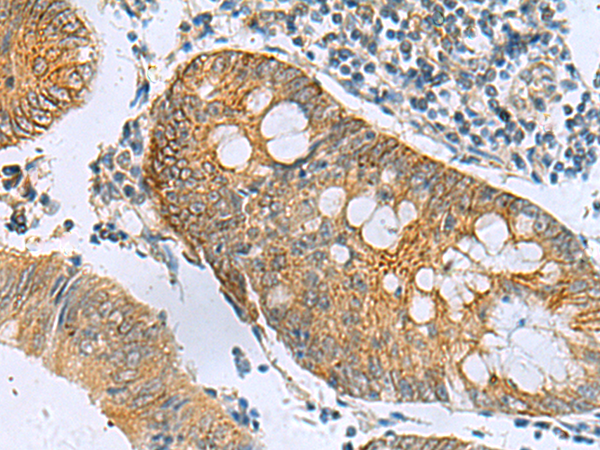 Rabbit Polyclonal Antibody to GUCA1A