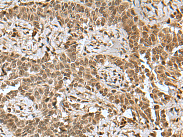 Rabbit Polyclonal Antibody to BCL7B