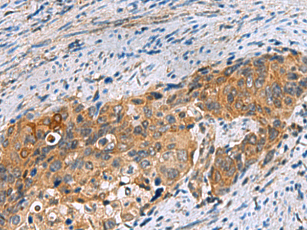 Rabbit Polyclonal Antibody to JOSD1