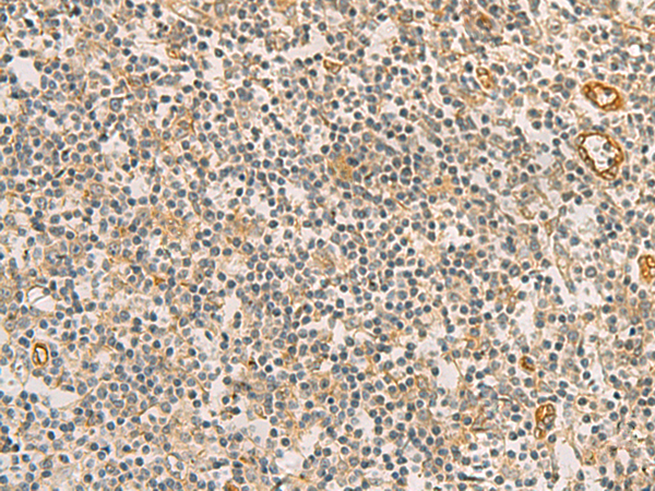 Rabbit Polyclonal Antibody to RAB13