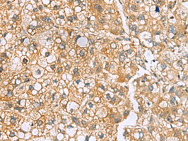 Rabbit Polyclonal Antibody to MRPL22