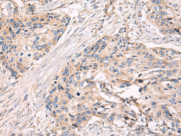 Rabbit Polyclonal Antibody to RAB18