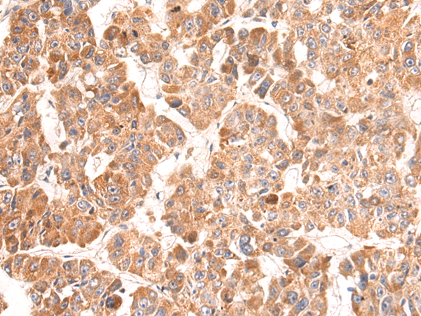 Rabbit Polyclonal Antibody to MRPL58