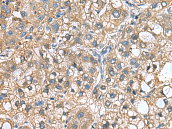 Rabbit Polyclonal Antibody to IGLL1
